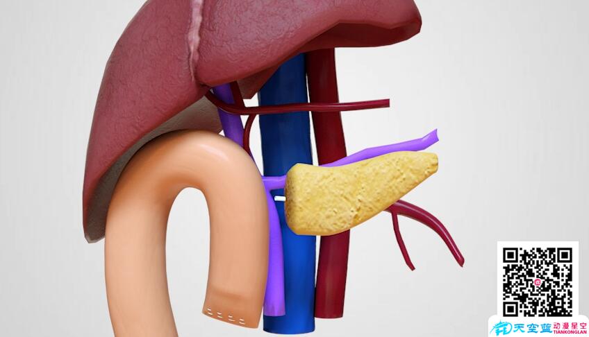 三維3d動畫演示胰十二指腸切除術(shù).jpg