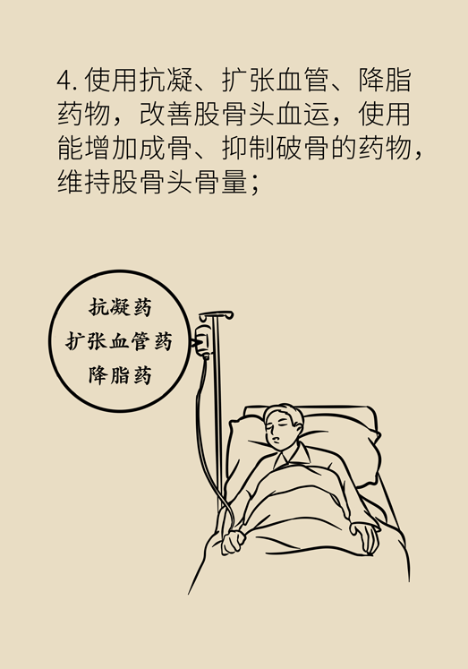 激素會帶來股骨頭壞死的后遺癥嗎？