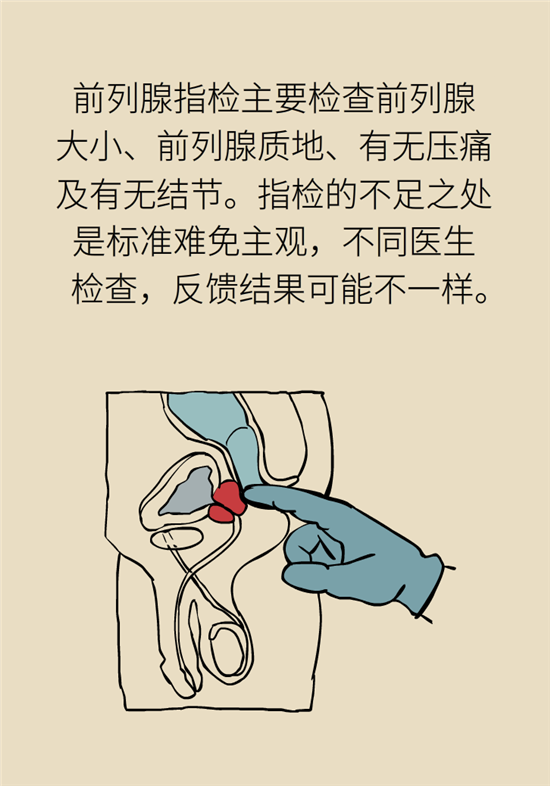 前列腺肥大了還能縮小嗎？