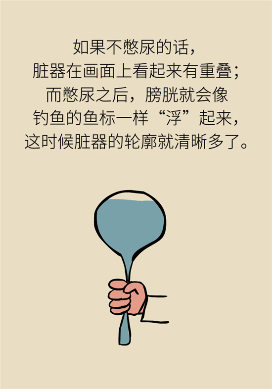 前列腺肥大了還能縮小嗎？