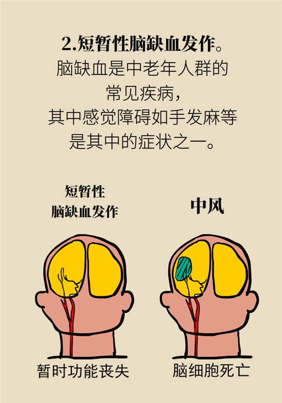 無(wú)緣無(wú)故的手麻，這是身體發(fā)出的什么信號(hào)？