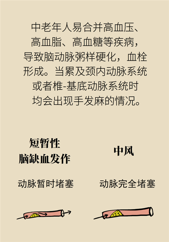 無(wú)緣無(wú)故的手麻，這是身體發(fā)出的什么信號(hào)？