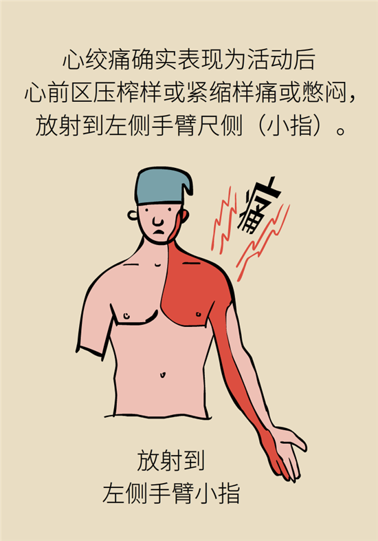 什么是冠心病，這些疼痛可能是心絞痛！