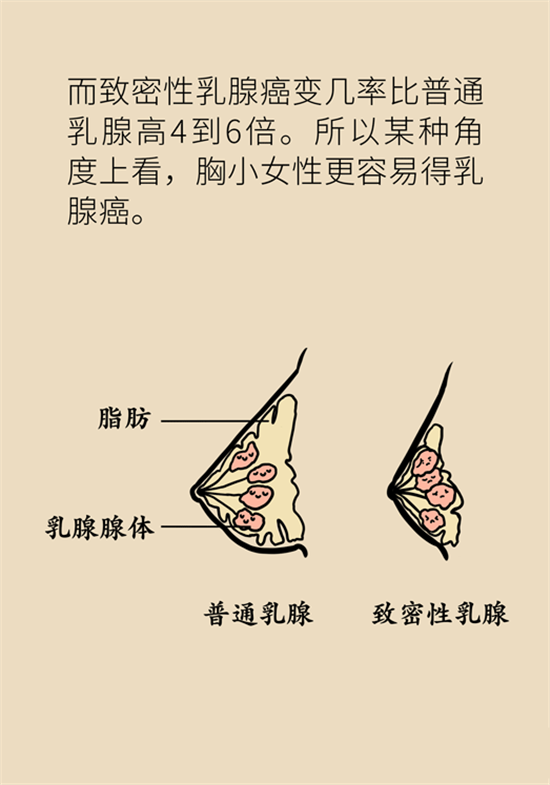 胸小是不是就不會患乳腺癌？