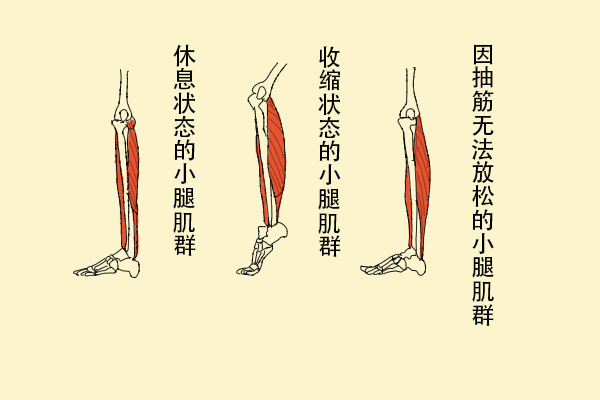 為什么缺鈣會(huì)導(dǎo)致抽筋？