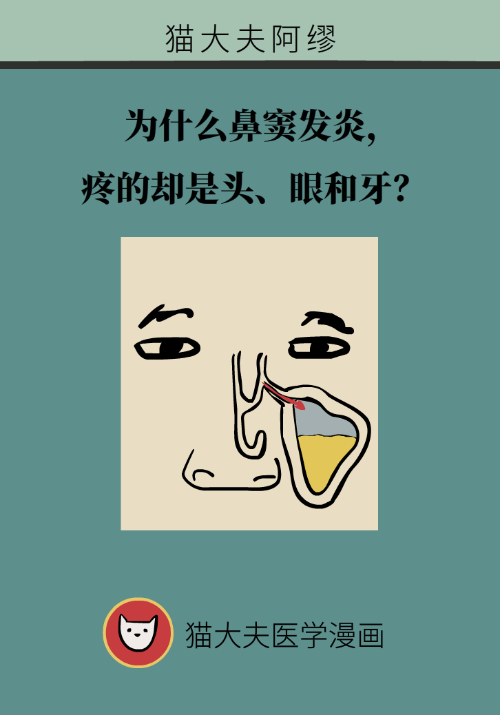 為什么鼻竇發(fā)炎，疼的卻是頭、眼和牙？