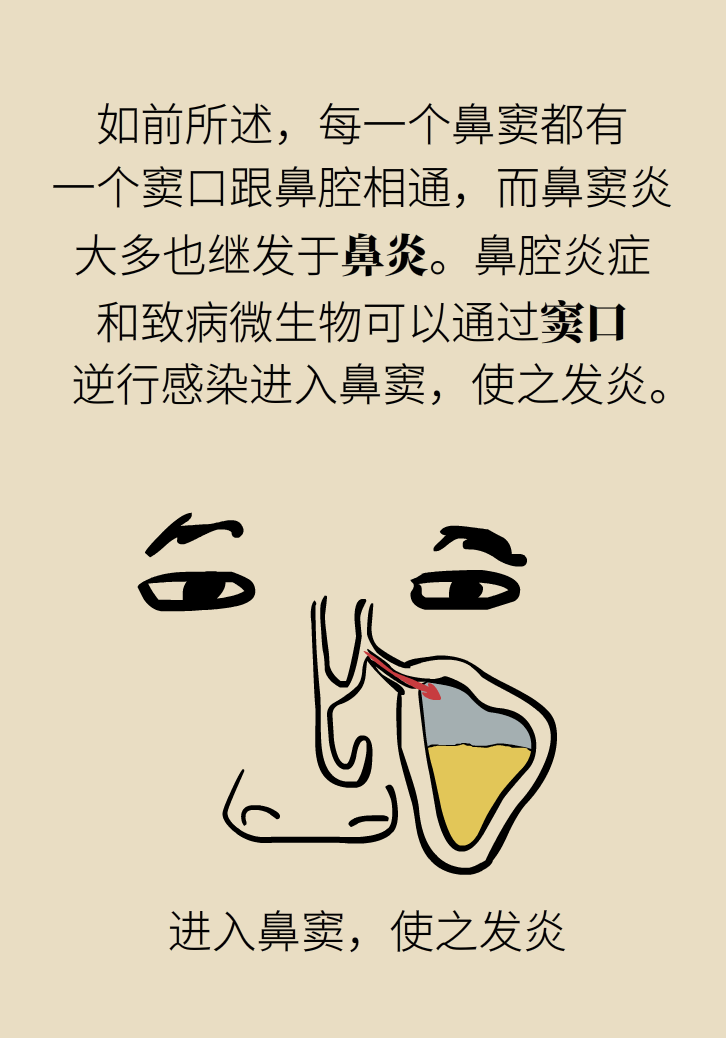 為什么鼻竇發(fā)炎，疼的卻是頭、眼和牙？