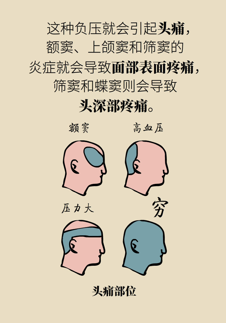 為什么鼻竇發(fā)炎，疼的卻是頭、眼和牙？