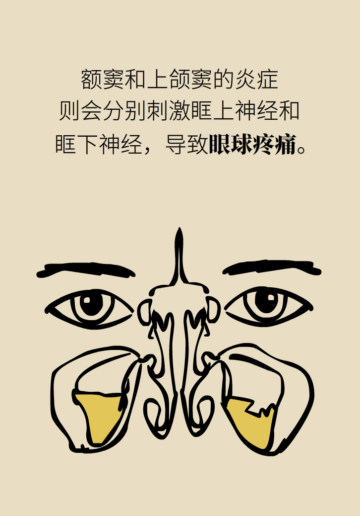 為什么鼻竇發(fā)炎，疼的卻是頭、眼和牙？