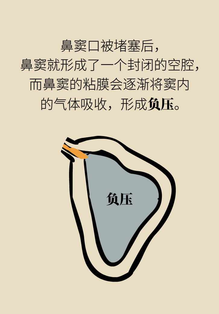 為什么鼻竇發(fā)炎，疼的卻是頭、眼和牙？