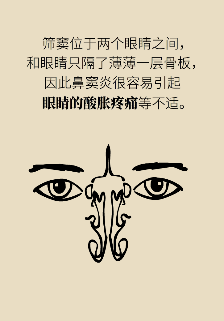 為什么鼻竇發(fā)炎，疼的卻是頭、眼和牙？