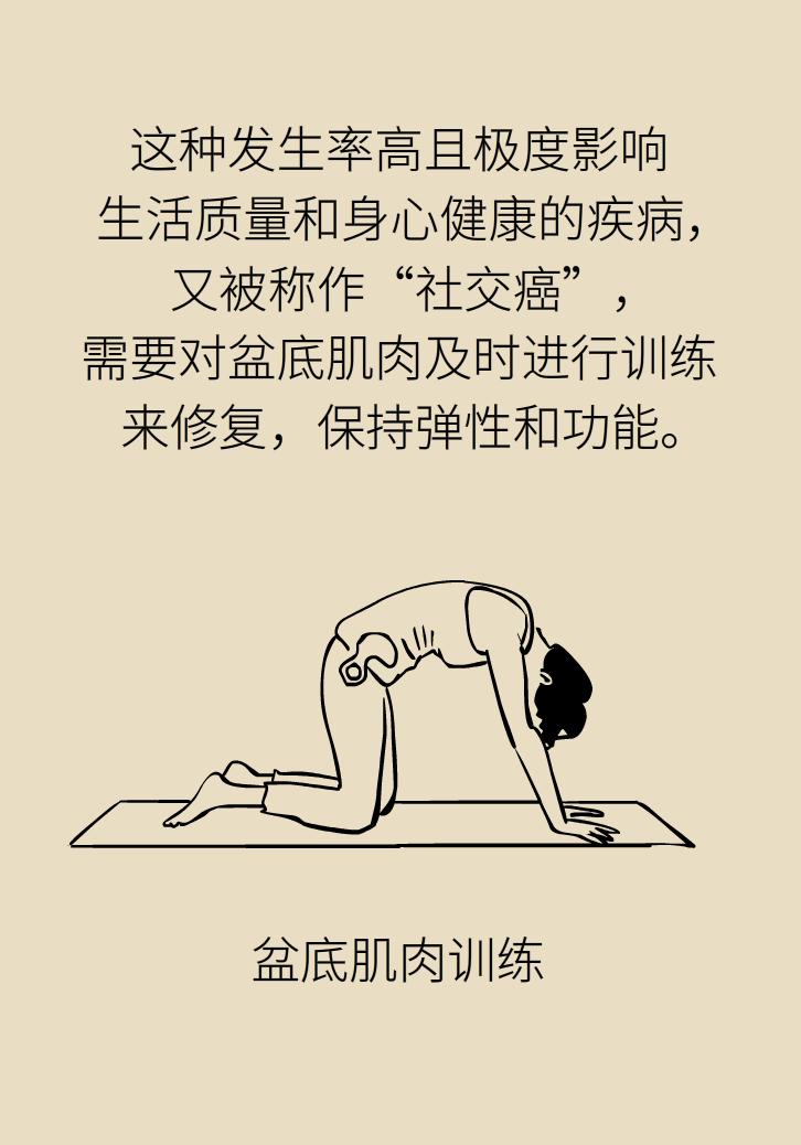 選擇剖腹產(chǎn)，就能避免盆底肌損傷嗎？