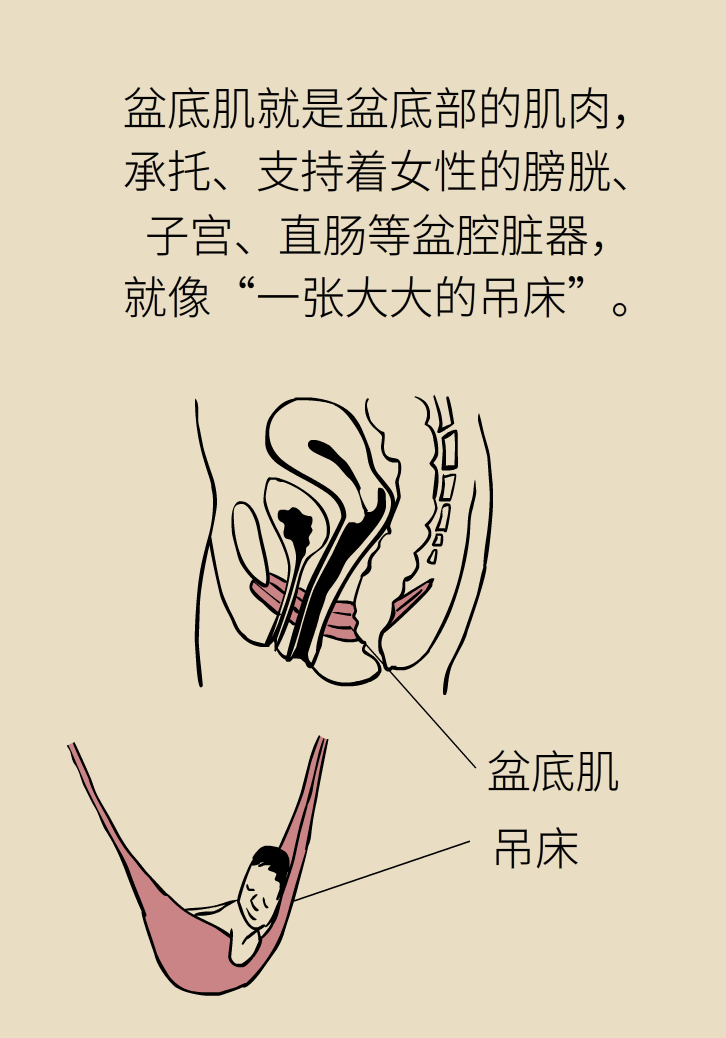 選擇剖腹產(chǎn)，就能避免盆底肌損傷嗎？