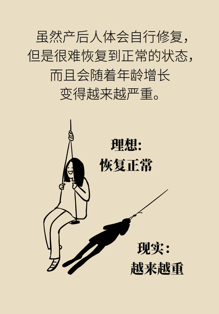 選擇剖腹產(chǎn)，就能避免盆底肌損傷嗎？