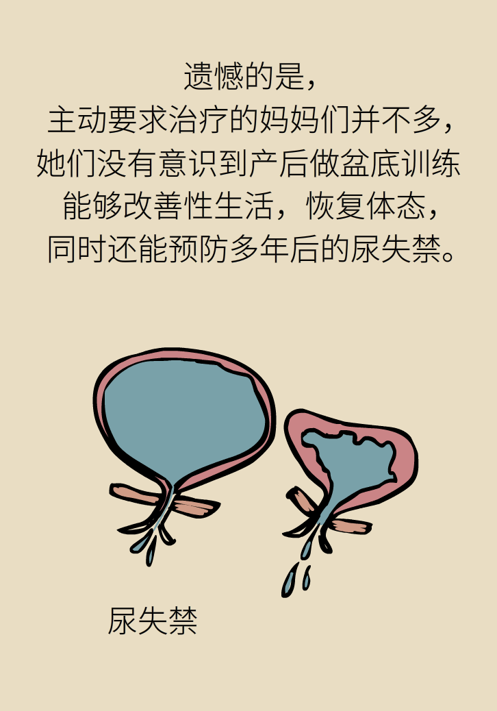 選擇剖腹產(chǎn)，就能避免盆底肌損傷嗎？