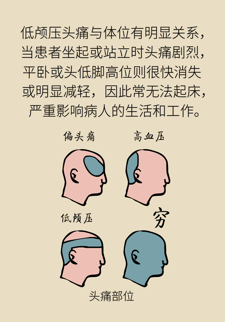 練瑜伽把腦脊液拉漏了！常見的“瑜伽病”你知道多少