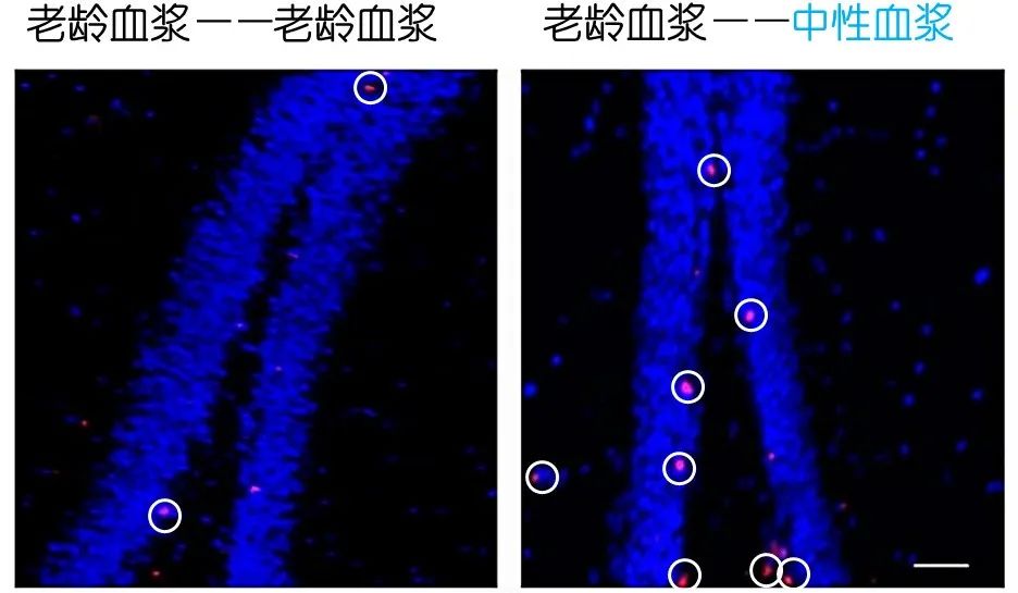 重返年輕不用大換血，只要給血液“兌點水”？