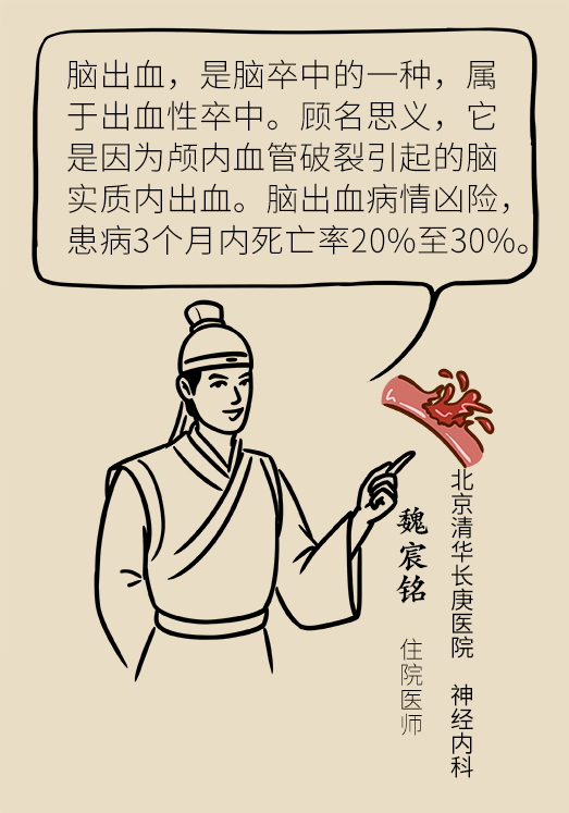 腦出血怎么辦？這些人群要格外注意