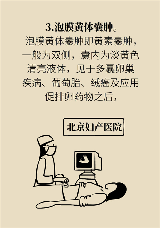 卵巢囊腫科普動漫：卵巢囊腫是腫瘤嗎？要學會這樣區(qū)分