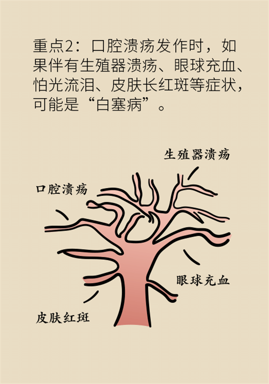 口腔潰瘍還想約火鍋？這四種情況一定要高度警惕