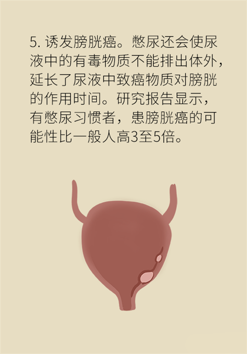 憋尿的7大危害，你真的了解嗎？
