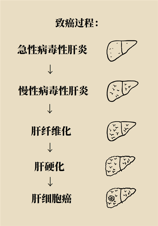 癌癥會(huì)傳染嗎？專家：這些高危因素得注意