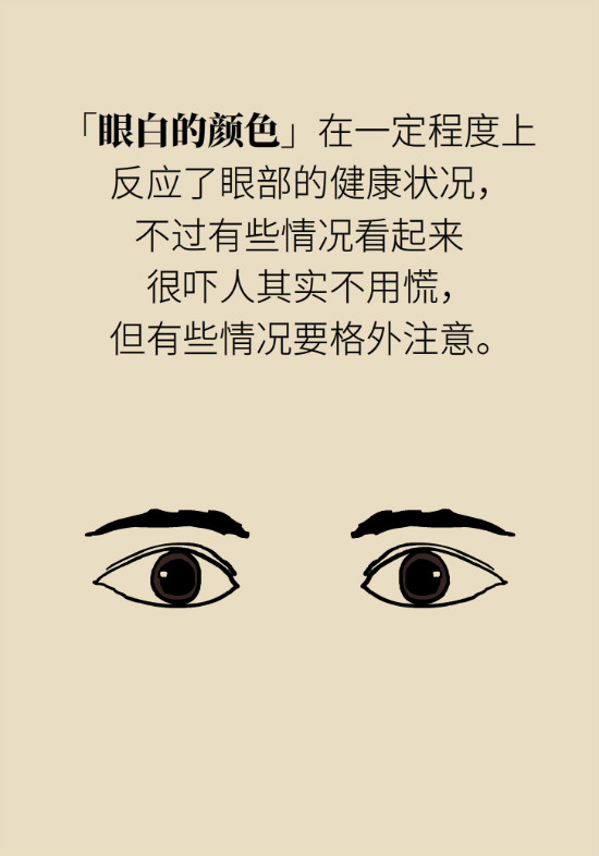 眼白有斑塊、出血要緊嗎？專家：名字唬人但問題不大