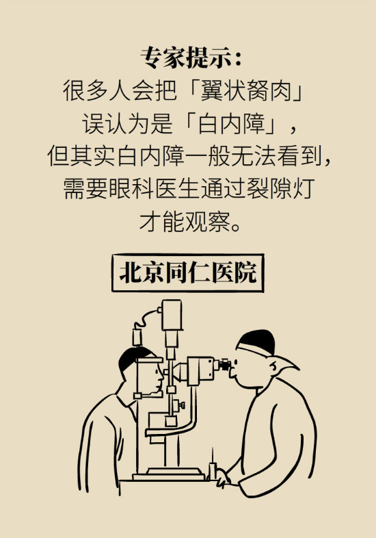 眼白有斑塊、出血要緊嗎？專家：名字唬人但問題不大