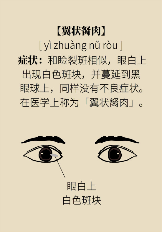 眼白有斑塊、出血要緊嗎？專家：名字唬人但問題不大