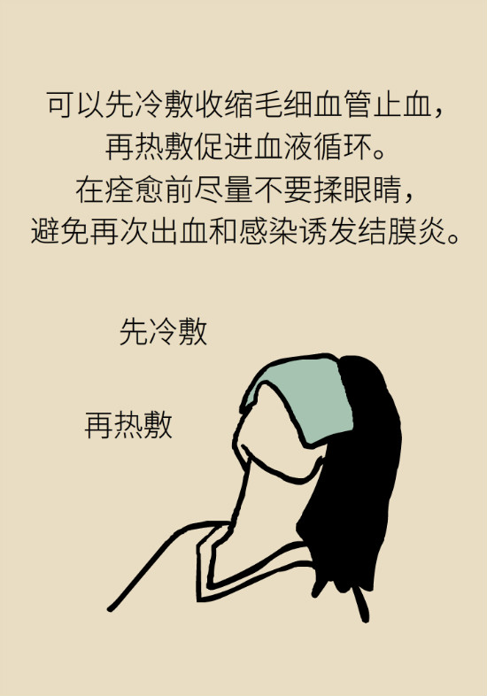 眼白有斑塊、出血要緊嗎？專家：名字唬人但問題不大