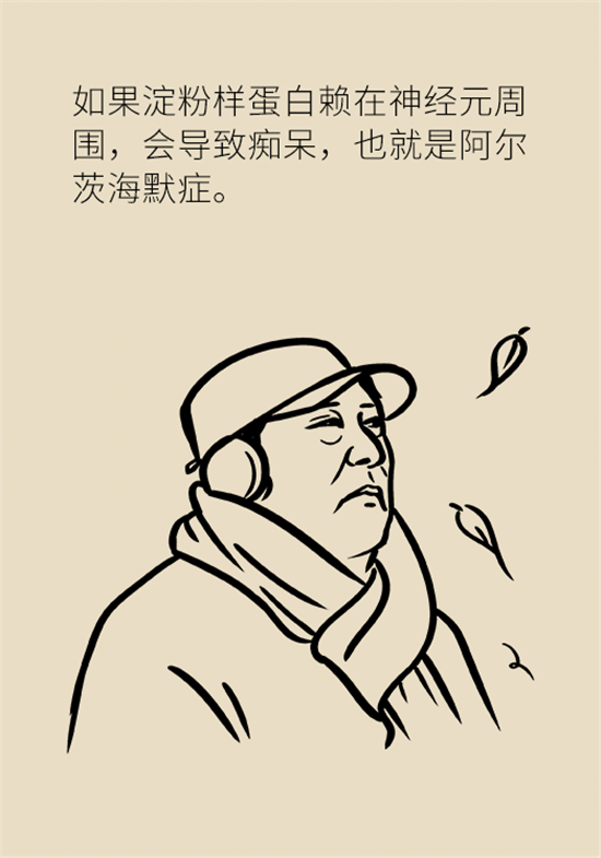 身體出現(xiàn)這些癥狀要小心，可能是腦出血發(fā)出的信號
