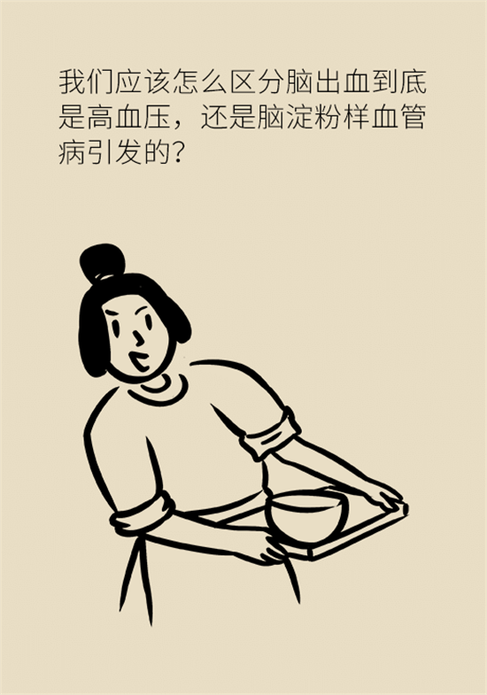 身體出現(xiàn)這些癥狀要小心，可能是腦出血發(fā)出的信號
