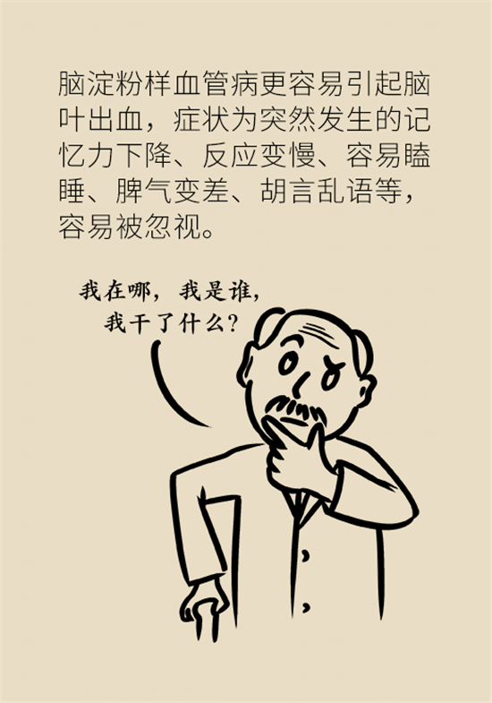 身體出現(xiàn)這些癥狀要小心，可能是腦出血發(fā)出的信號