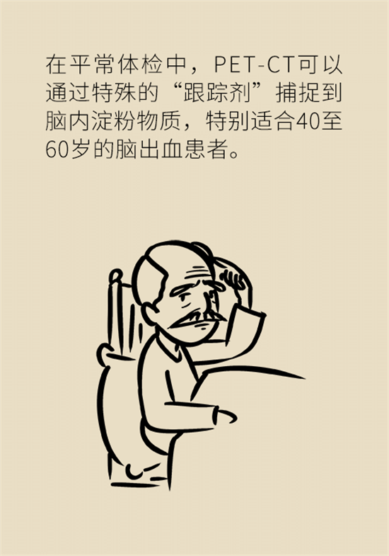 身體出現(xiàn)這些癥狀要小心，可能是腦出血發(fā)出的信號