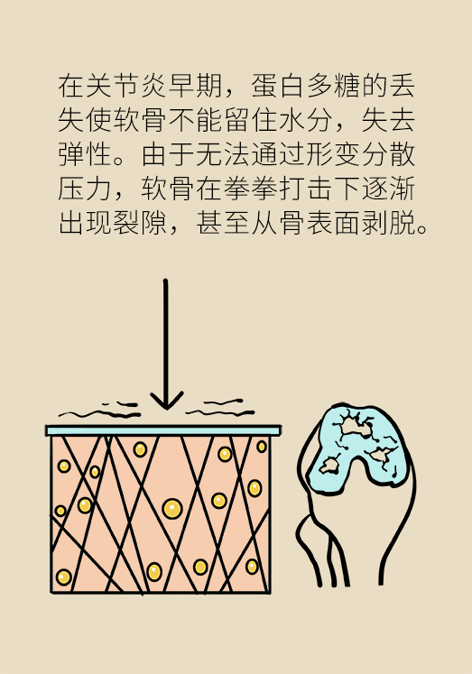 人老關(guān)節(jié)也會老嗎？