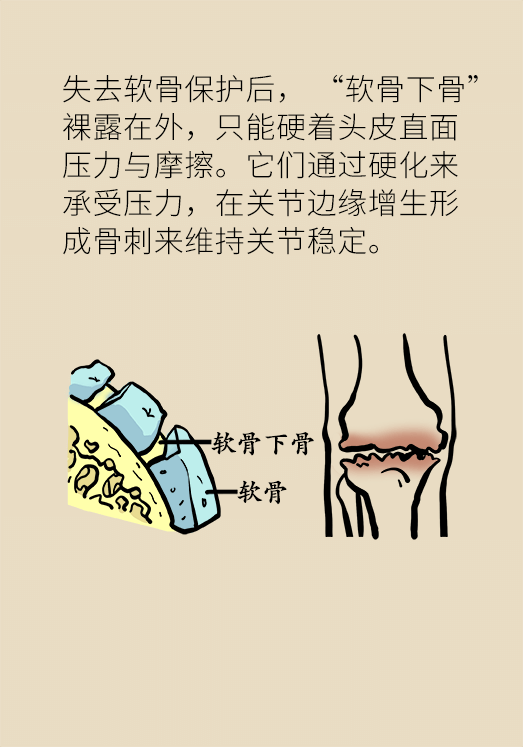 人老關(guān)節(jié)也會老嗎？