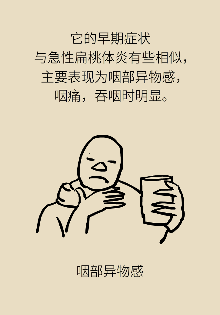 單側(cè)扁桃體腫大更兇險(xiǎn)！謹(jǐn)防惡性腫瘤