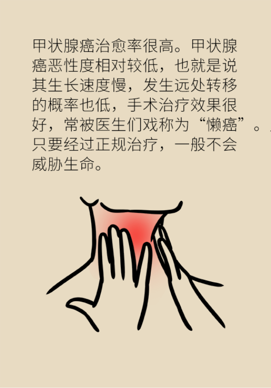 甲狀腺結(jié)節(jié)離癌有多遠(yuǎn) 甲狀腺科普動(dòng)漫制作