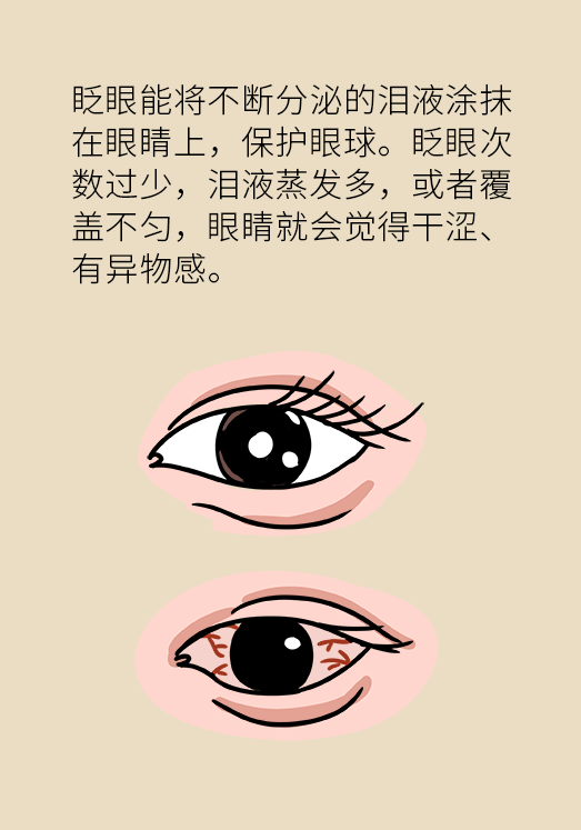 熬夜追劇后眼睛干澀疼痛？
