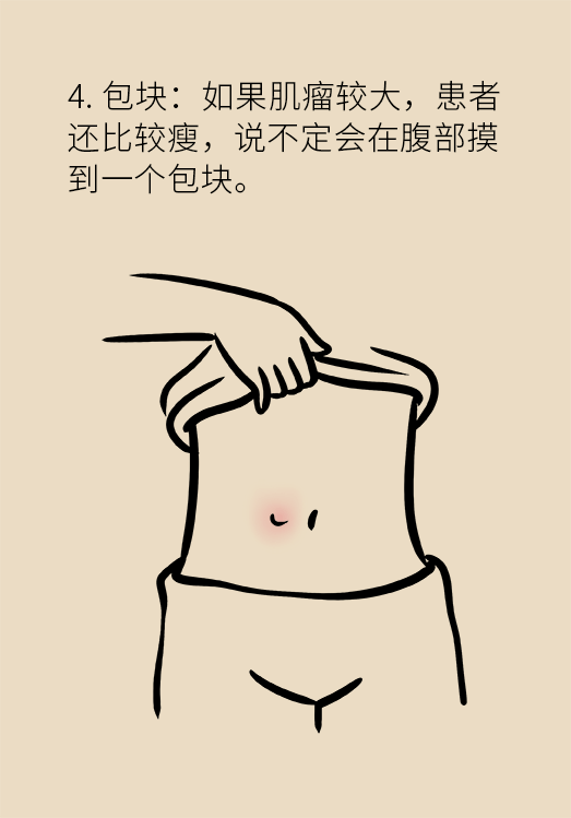 子宮肌瘤科普動漫制作