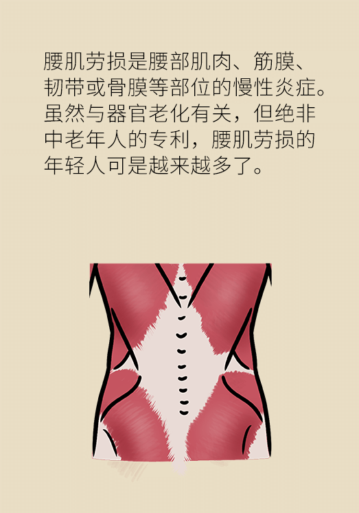 久坐久站致腰肌勞損？六招教你戰(zhàn)勝腰痛
