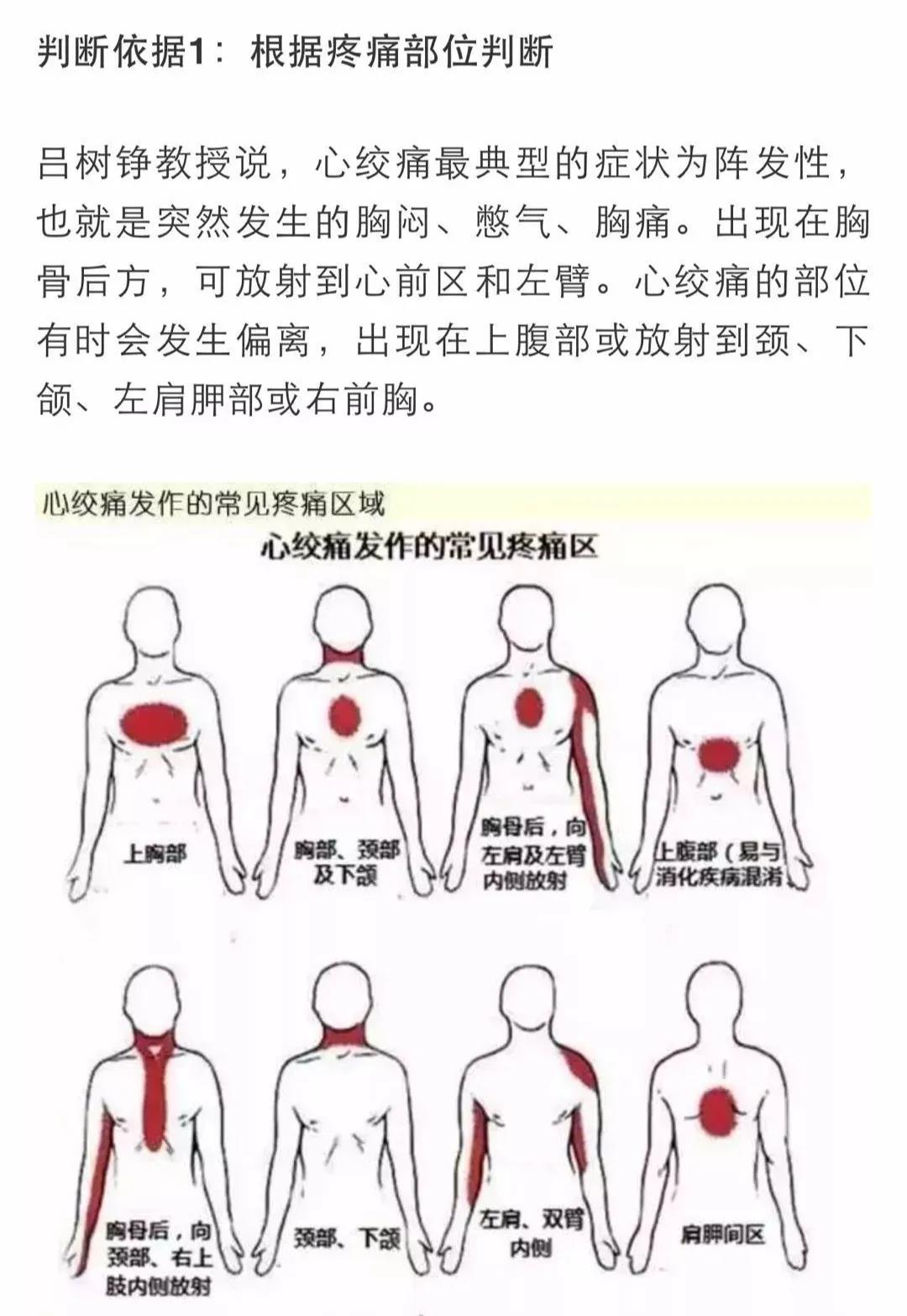 心梗有前兆！心臟發(fā)出的警報(bào)你在意了嗎？