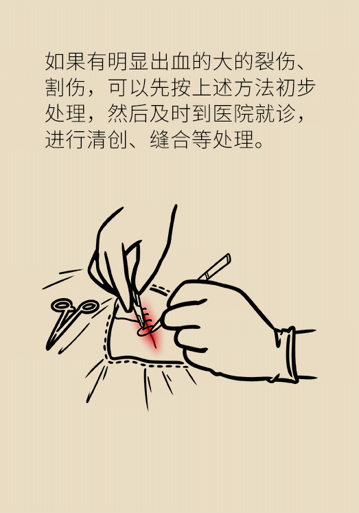 傷口處理