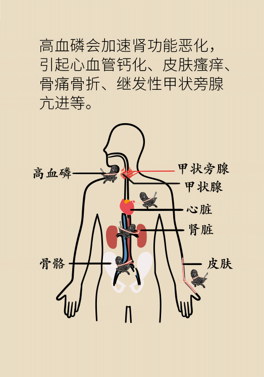 腎科普動(dòng)漫制作