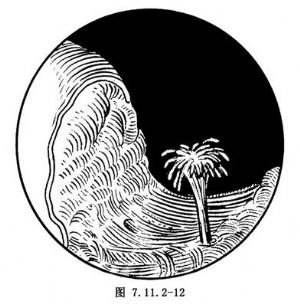 經(jīng)尿道前列腺切除術(shù)