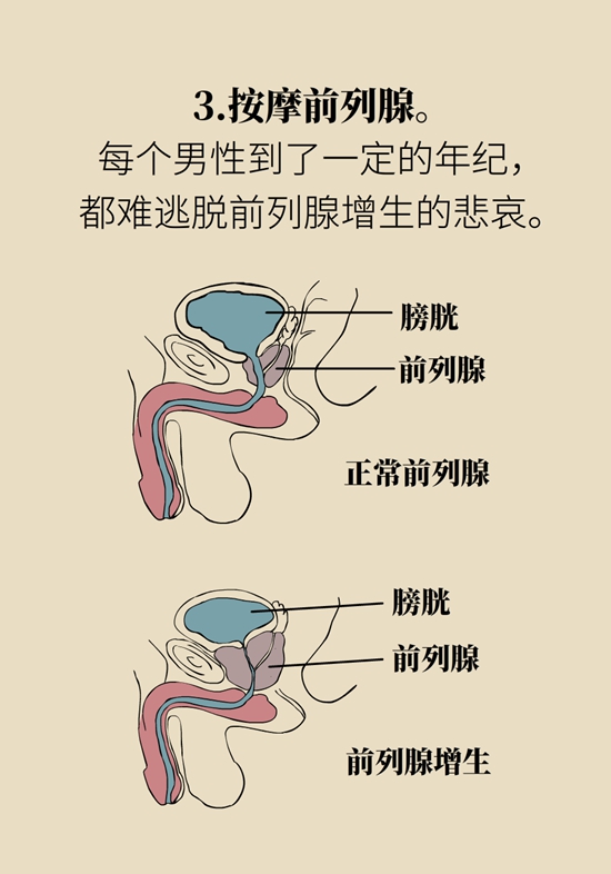 怎么做可以預(yù)防痔瘡呢？按摩前列腺、鍛煉盆底肌