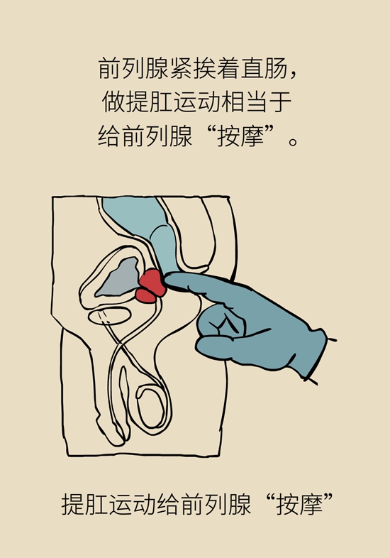 怎么做可以預(yù)防痔瘡呢？按摩前列腺、鍛煉盆底肌