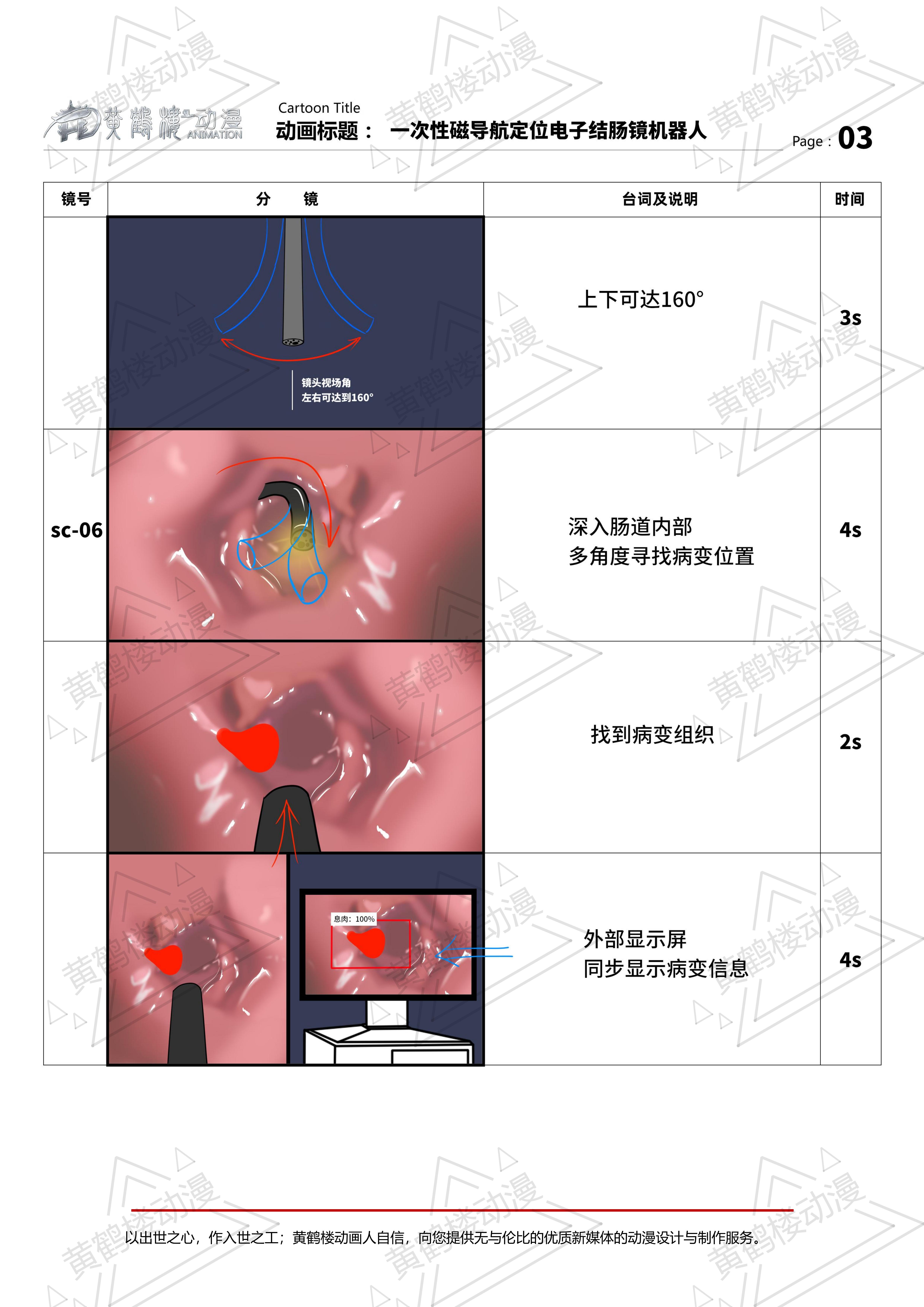 一次性磁導航定位電子結(jié)腸鏡機器人三維動畫分鏡210514_02.jpg