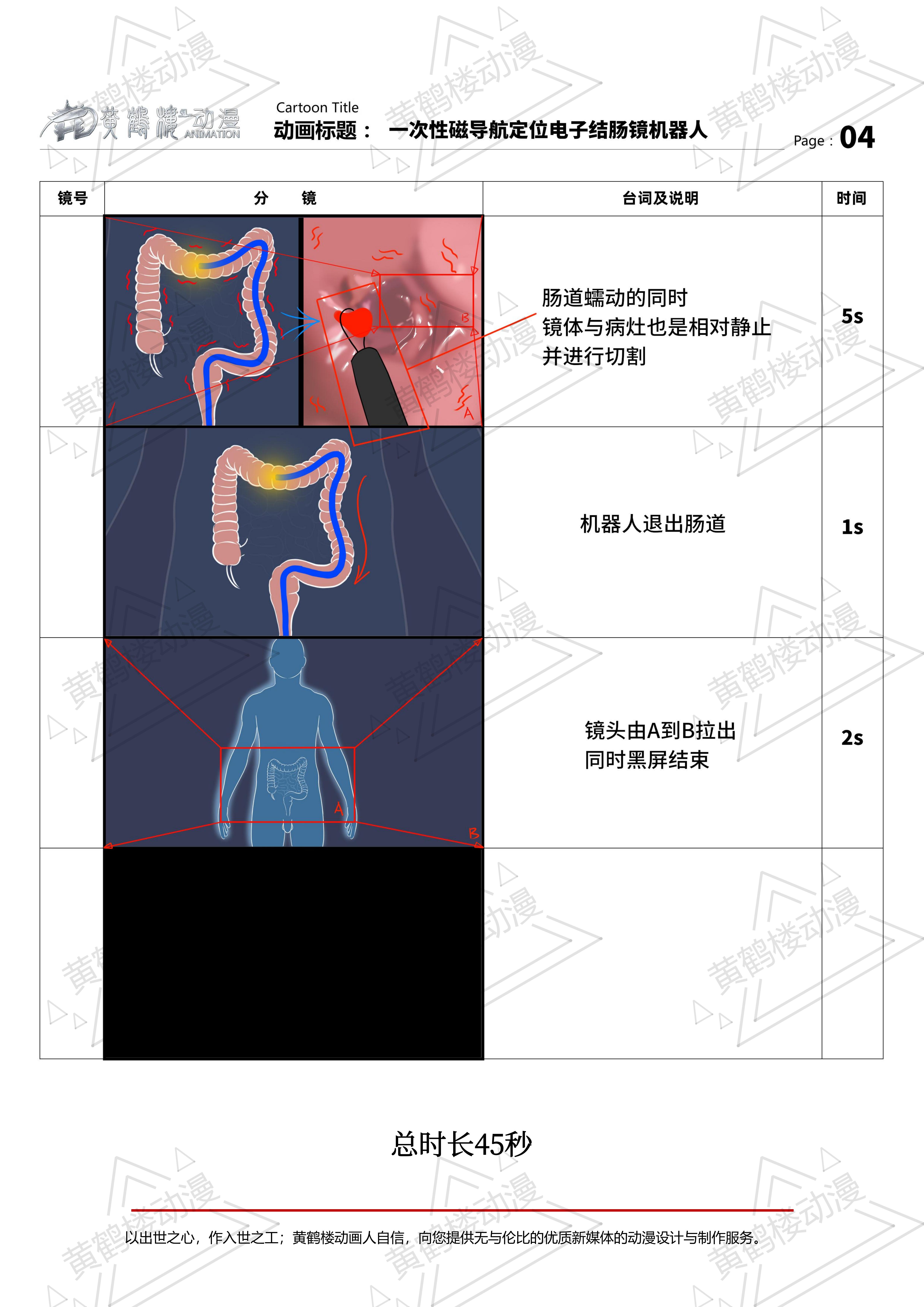 一次性磁導航定位電子結(jié)腸鏡機器人三維動畫分鏡210514_03.jpg